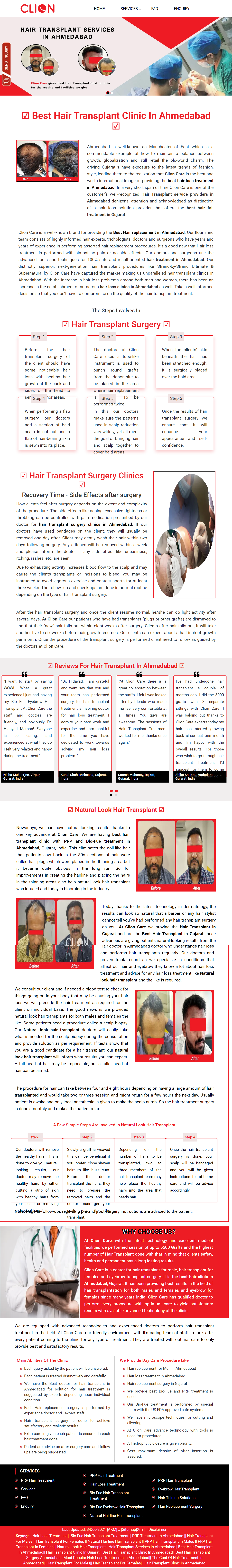 Hair Transplant clinic India
